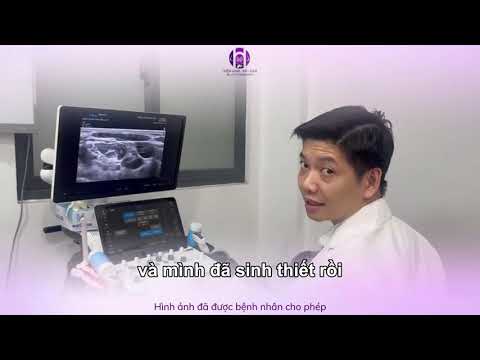 Hình ảnh siêu âm hé lộ ung thư vú đa ổ di căn hạch