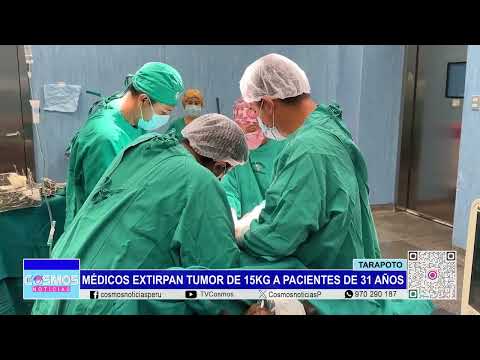 Tarapoto: médicos extirpan tumor de 15 g a pacientes de 31 años