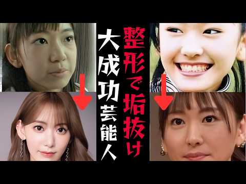 整形後の芸能人変身特集：垢抜けた秘訣と話題のポイント サムネイル