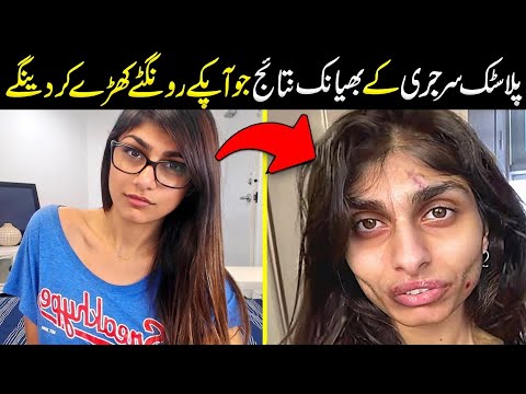 Plastic Surgery Changed Them Forever | 5 Celebrities Before and After Plastic Surgery