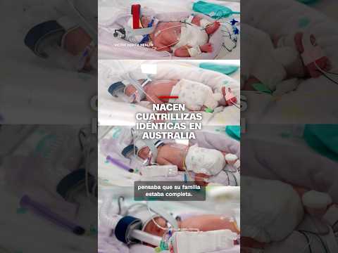 Nacen cuatrillizas idénticas en Australia