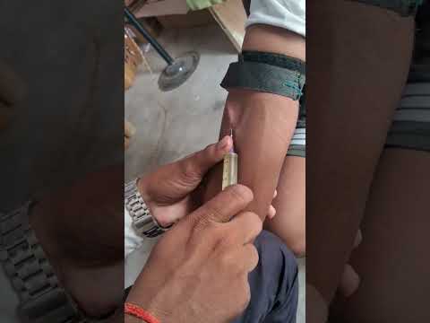 #bestmedicalcollegeinindia #injection #trending # डॉक्टर real