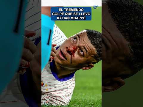 El TREMENDO golpe que se llevó Kylian Mbappé #mbappe  #eurocopa2024 #eurocopa