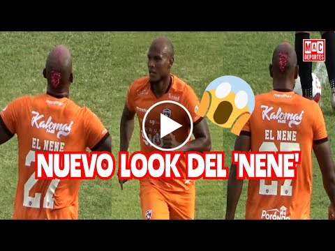 El nuevo look de Erik 'Nene' Correa, se pintó de rosa el pelo | Mac Deportes
