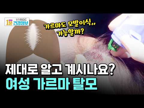 여성 가르마 탈모, 오해와 진실! [🏥1분 건강정보]