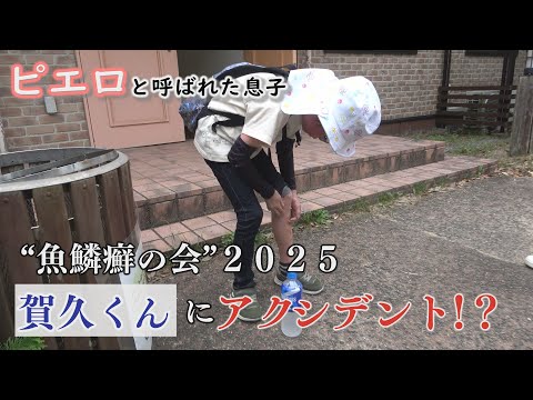 【最新話】魚鱗癬の病名変更 患者や家族の受け止めは? ~配信型ドキュメンタリー「ピエロと呼ばれた息子」第136話
