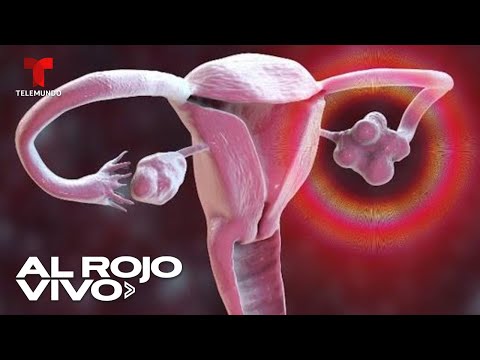 Expertos crearon el primer atlas celular del ovario que ayudaría con la fertilidad