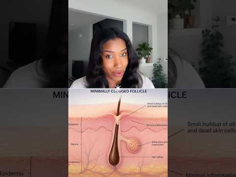 Your Scalp Build Up May Be Slowing Hair Growth!