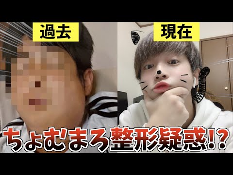 【荒野行動】僕の整形疑惑についてお話しします。。。。