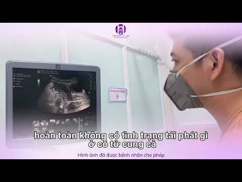 Giải mã triệu chứng đi cầu ra m.áu sau xạ trị ung thư cổ tử cung