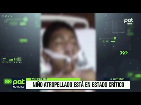 Niño atropellado en Montero está en estado crítico - Parte 3