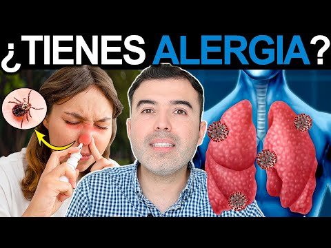 NO ES NORMAL TENER ALERGIAS - La Solucion Definitiva A Las Alergias