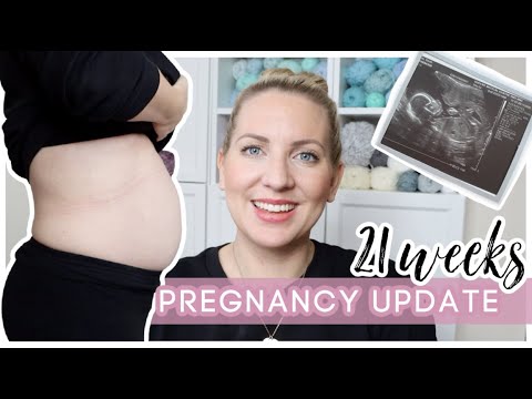 21 WEEK PREGNANCY UPDATE | FIRST TRIMESTER | SICKNESS | BUMP SHOT | 2nd BABY | Sarah-Jayne Fragola
