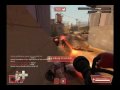 TF2 - How to play the Medic