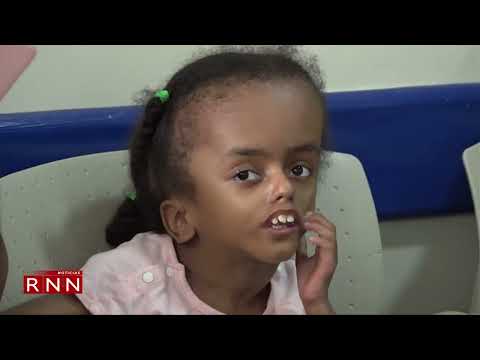 Clínica Cruz Jiminián operará 100 niños con hidrocefalia