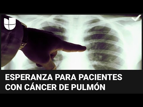 Ponen a prueba la primera vacuna contra el cáncer de pulmón: te explicamos cómo funciona