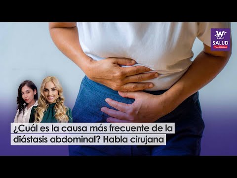 ¿Cuál es la causa más frecuente de la diastasis abdominal? Habla cirujana | Salud y Algo Más