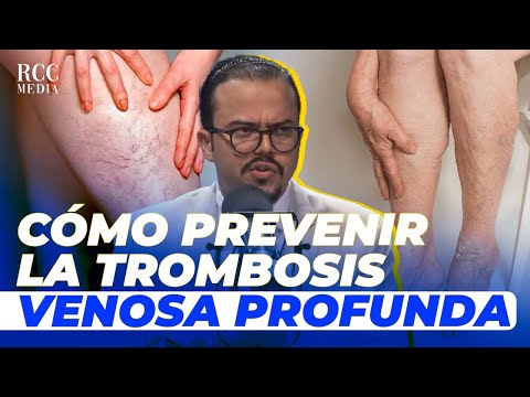 Dr. Miguel González: La trombosis venosa profunda en RD “Ser mujer ya es un factor de riesgo”