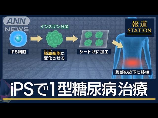 Image of Kyoto University Menargetkan 2030 untuk Terapi Sel iPS dalam Melawan Diabetes