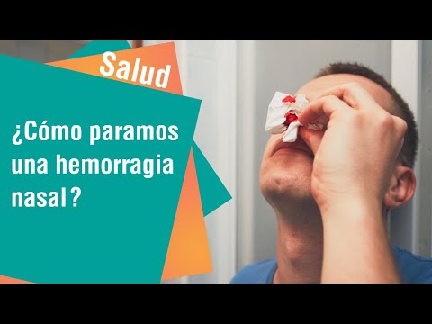 ¿Cómo paramos una hemorragia nasal | Salud