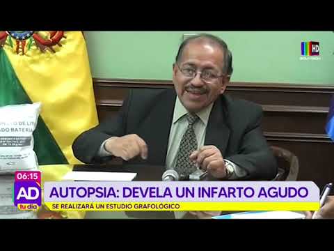 Juan Carlos Montenegro: Autopsia devela un infarto agudo