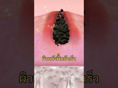 ทำไมต้องพลิกตัว!ทุกๆ2ชั่วโม