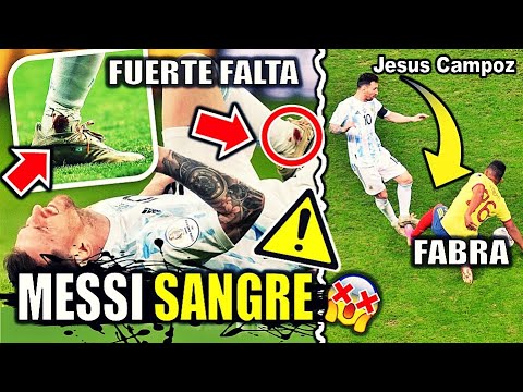 Messi SANGRE en TOBILLO por falta de Fabra | Colombia vs Argentina - Copa America | Frank disculpa