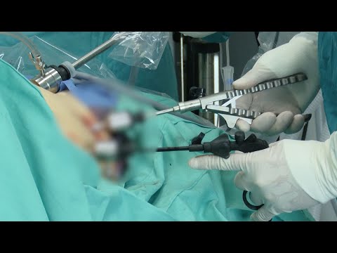 Investigan muerte mujer cirugía plástica - Teleantioquia Noticias