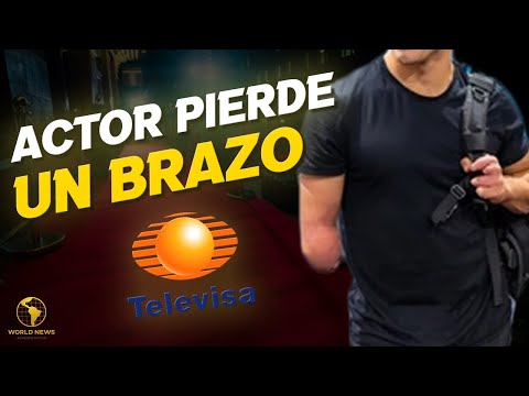 Actor de Televisa PIERDE UN BRAZO