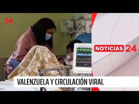 Valenzuela y circulación viral: “Este año estamos teniendo cuatro veces más casos notificados”