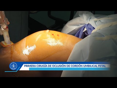 Novedosa cirugía fetal se realiza en la república de Panamá, en salón de operaciones del CHMAG