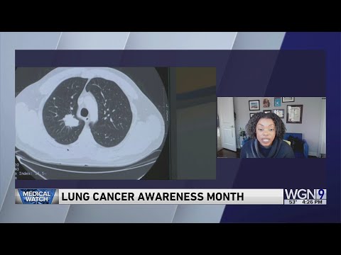 Lung cancer is leading cause of death amongst Illinoisans