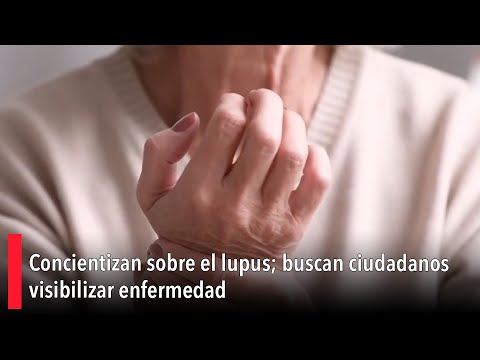 Concientizan sobre el lupus; buscan ciudadanos visibilizar enfermedad