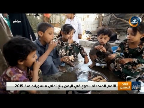 نشرة أخبار الثالثة مساءً | الأمم المتحدة: الجوع في اليمن بلغ أعلى مستوياته منذ 2015 (2 يوليو)