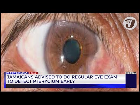 Jamaica Advised to Do Regular Eye Exams to Detect Pterygium Early
