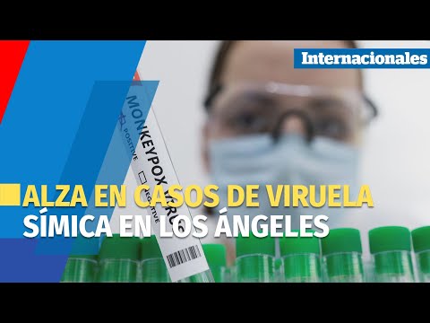 Área de Los Ángeles ve alza en casos de viruela símica por transmisión comunitaria