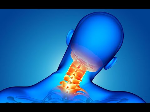 ¿Qué activa un dolor en las cervicales?
