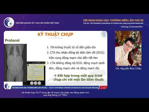 3. Kỹ thuật chụp CLVT lập kế hoạch cấy ghép van động mạch chủ qua ống thông (CN. Nguyễn Bữu Châu)