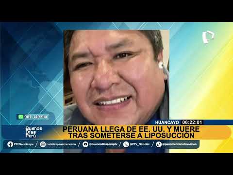 Muere en Huancayo peruana que llegó de Estados Unidos tras someterse a liposucción