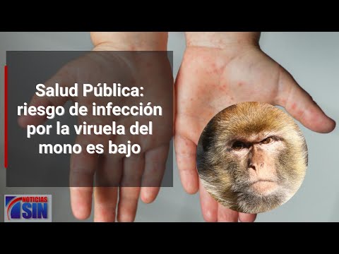 Salud Pública: riesgo de infección por la viruela del mono es bajo