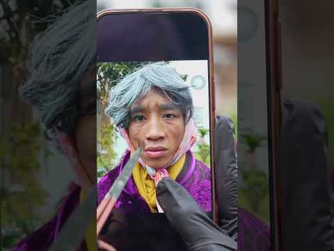 Lông mi | Oppa Huy