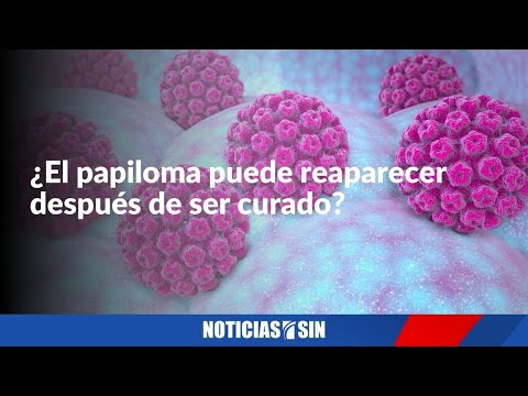 ¿El papiloma puede reaparecer después de ser curado?