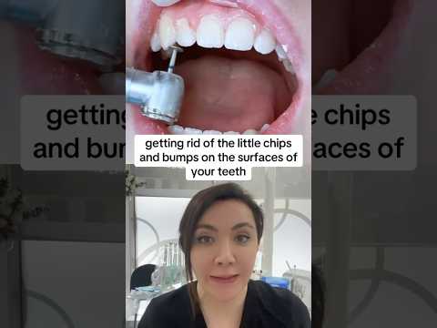 How You Can Get Your Teeth Chips Fixed?!