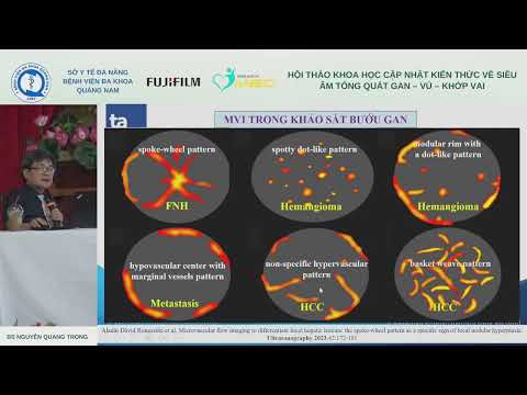 [S] Siêu âm vi mạch u gan: các kiểu hình tưới máu (BS Nguyễn Quang Trọng)