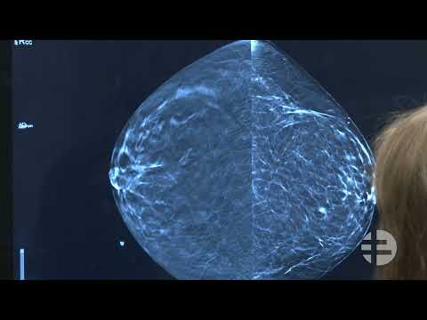 Understanding Mammograms And What To Expect When You Get One | Sanford
Health News