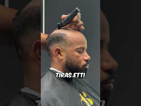 Berberin O Anlamlı Bakışı Her Şeyi Ele Verdi.. 👀💇♂️