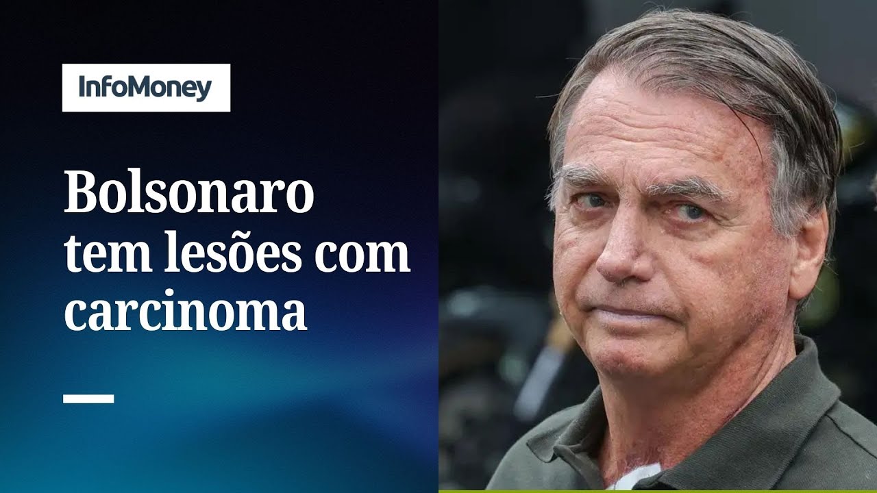 Bolsonaro recebe alta e tem câncer de pele: lesões foram retiradas | InfoMoney News