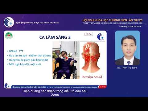 4. Điện quang can thiệp trong điều trị đau sau Zona (TS. Trịnh Tú Tâm)