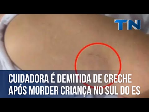 Cuidadora é demitida de creche após morder criança no Sul do ES