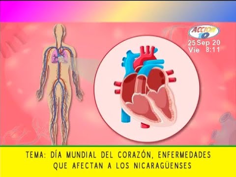 Las enfermedades al corazón que afectan a los nicaragüenses